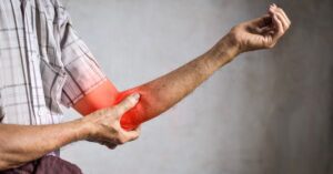 Read more about the article Medial Epicondylalgia (Golfer’s Elbow): What It Is and How Physiotherapy Can Help