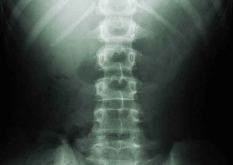 X-Ray Results